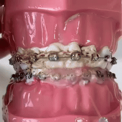 🦷Irrigador dental 🦷